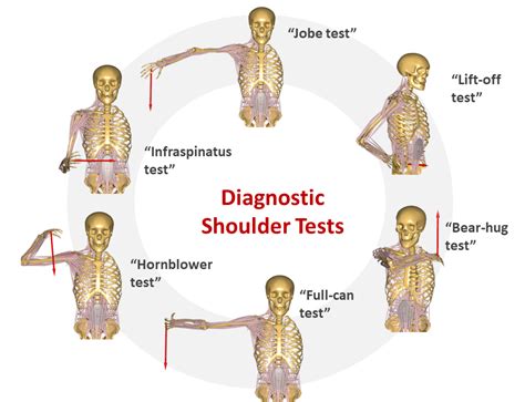 what test for rotator cuff tear|special tests for rotator cuff tear.